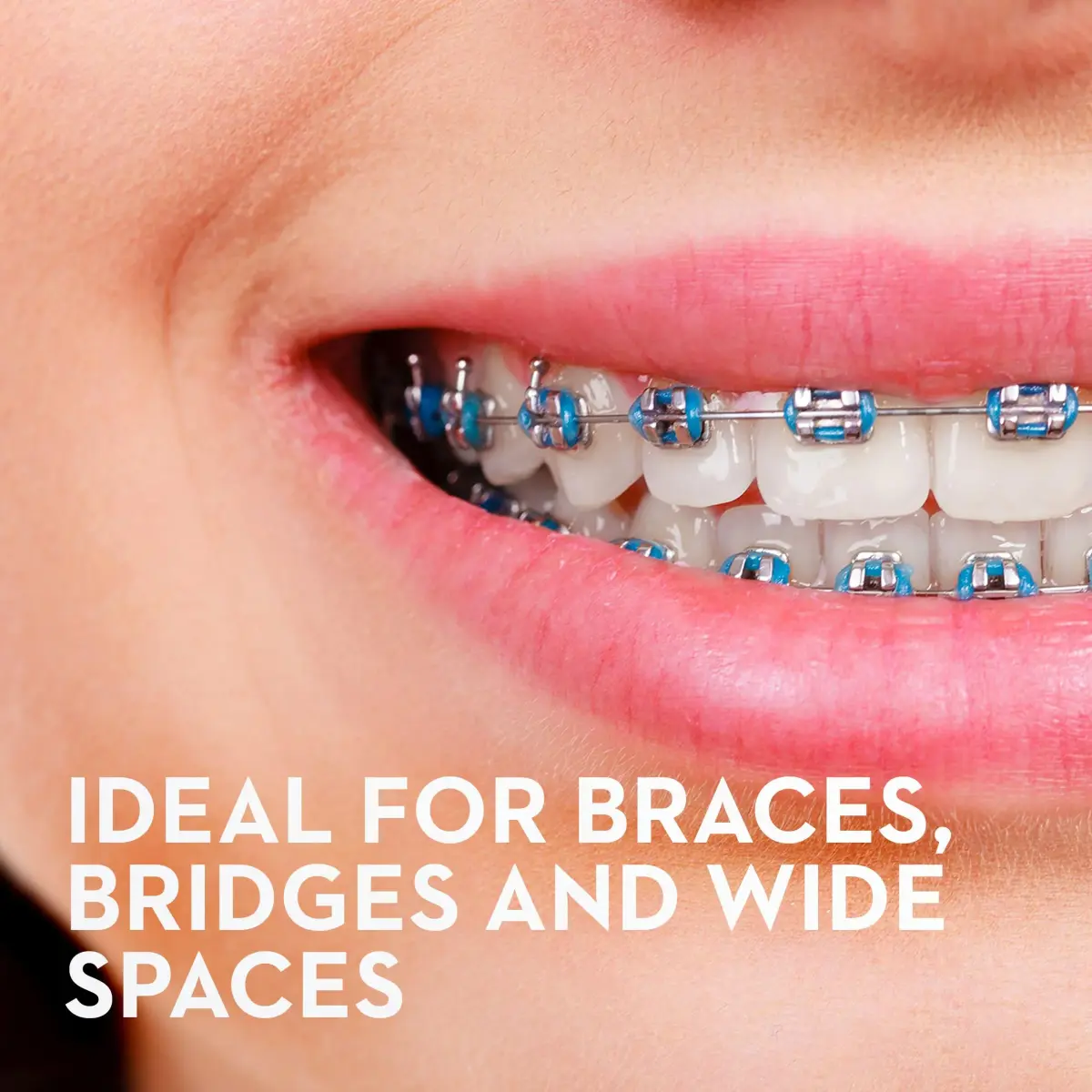 Oral-B Super Floss Pre-Cut Strands, 50 Count (15g) | Mint Flavor Dental Floss for Bridges, Braces, and Wide Spaces - view 7