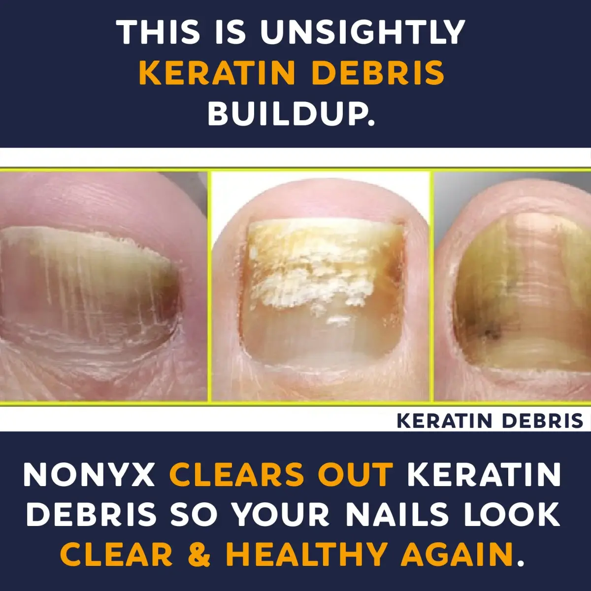 NONYX Fungal Nail Clarifying Gel 118ml (4 Fl Oz) | Clinically Proven to Improve Nail Appearance - view 7