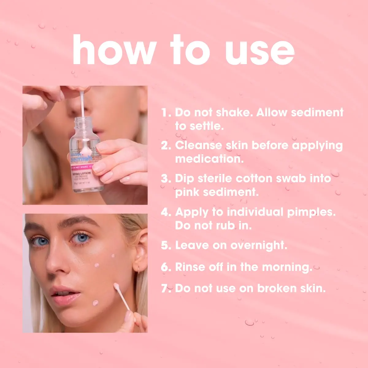Bye Bye Blemish Drying Lotion 29.5ml | Rapid Pimple Reduction Overnight - view 6