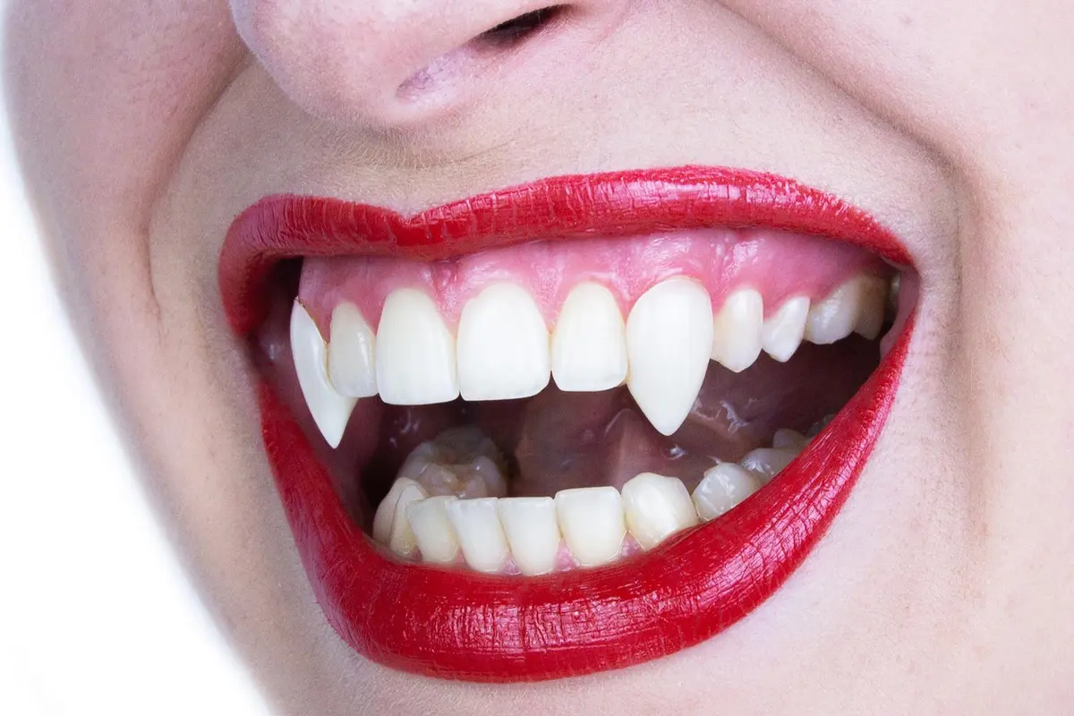 Scarecrow Small Deluxe Custom Fangs | Reusable, Realistic, Safe for Teeth - view 3