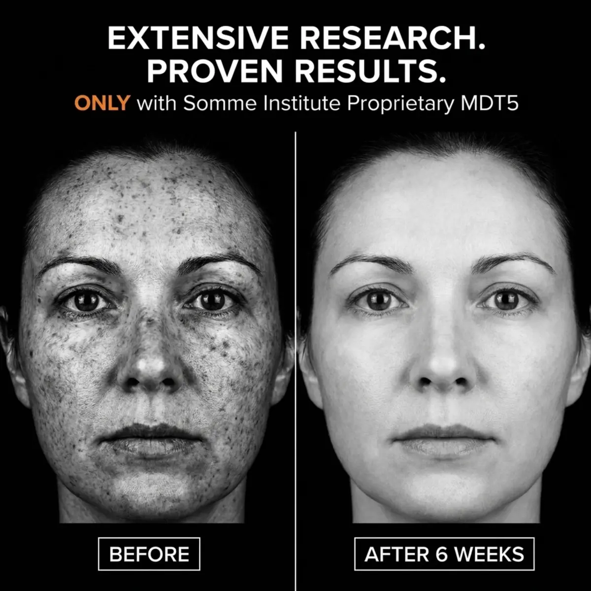 Somme Institute Alcohol-Free Skin Cleaning Wipe | Glycolic Acid Pads for Face & Pores | 50 Ct. - view 4
