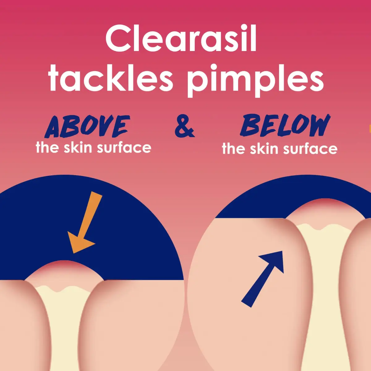 Clearasil Rapid Rescue Deep Treatment Acne Face Pads, Maximum Strength 2% Salicylic Acid, 90 Count - view 3