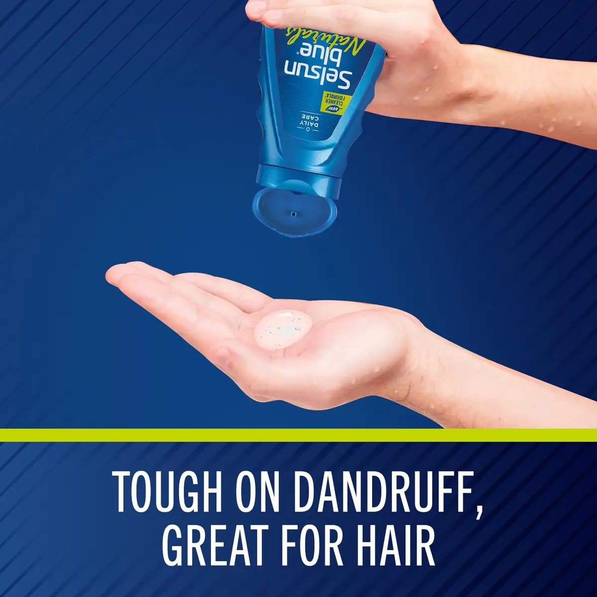 Selsun Blue Naturals Itchy Dry Scalp Antidandruff Shampoo 11 fl. oz. | Controls scalp psoriasis, relieves itching, free from harmful chemicals - view 3