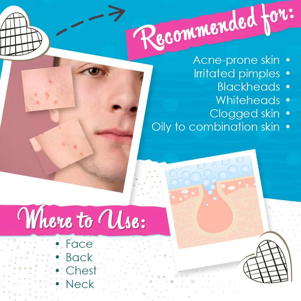 Bye Bye Blemish Acne Drying Lotion 1oz | Overnight Pimple Treatment for All Skin Types - view 3