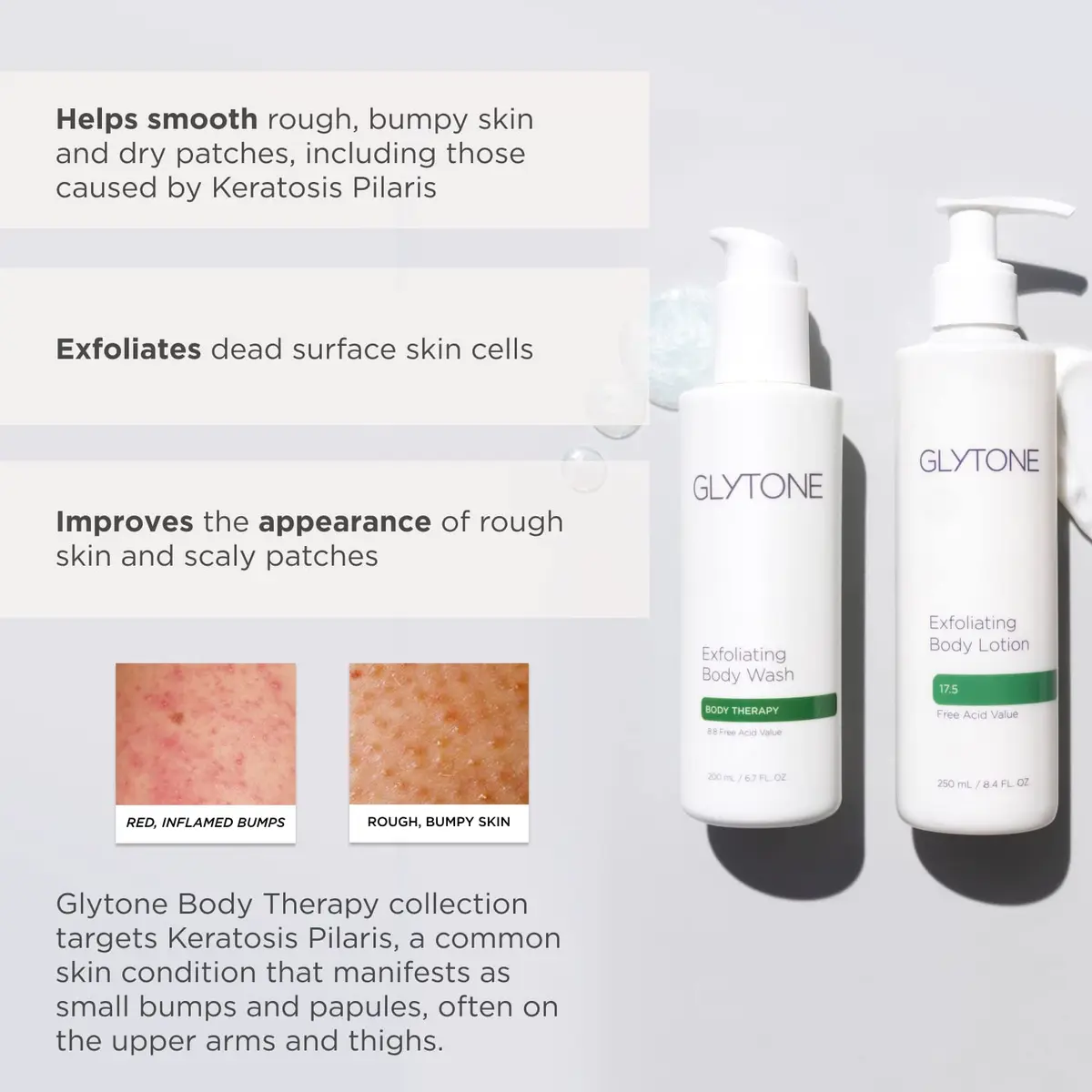 GLYTONE Glytone Exfoliating Body Lotion for Dry Skin | 17.5% PFAV Glycolic Acid, Reduce Keratosis Pilaris, Fragrance-Free, 8.4 Fl Oz - view 5