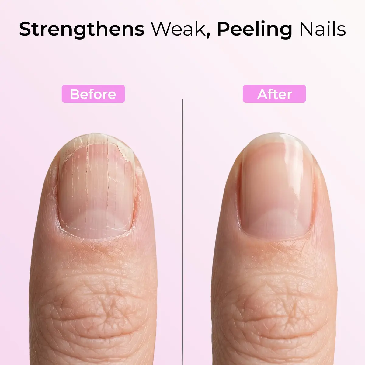 Orly Nail Rescue Kit | Repairs Cracked, Broken Nails | Compact Kit with Nail Glue, Powder & Buffer for Flawless Nails - view 2