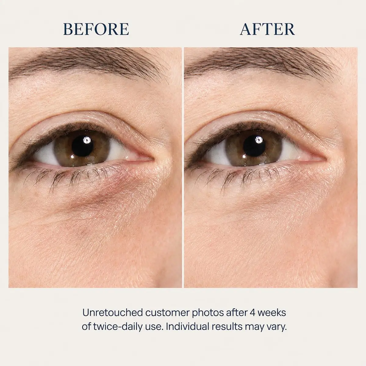 Osmotics Cosmeceuticals Under Eye Rejuvenator 15ml | Peptide Serum for Dark Circles & Puffiness - view 4