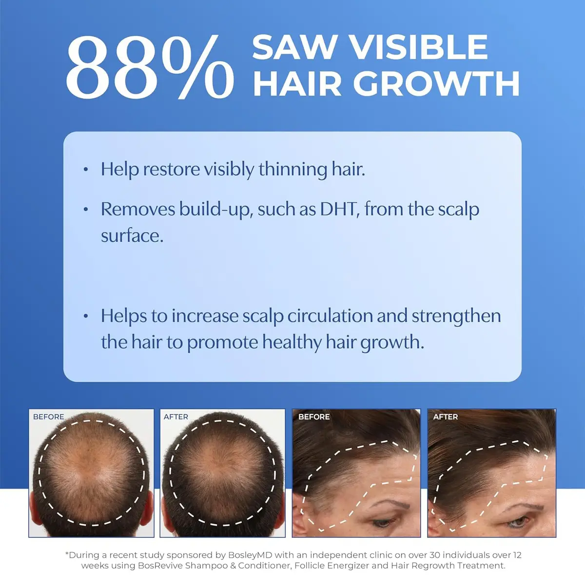 BosleyMD BOSRevive Volumizing Hair System for Non Color-Treated Hair – DHT-Blocking Shampoo, Conditioner & Thickening Treatment (30 Days) - view 6