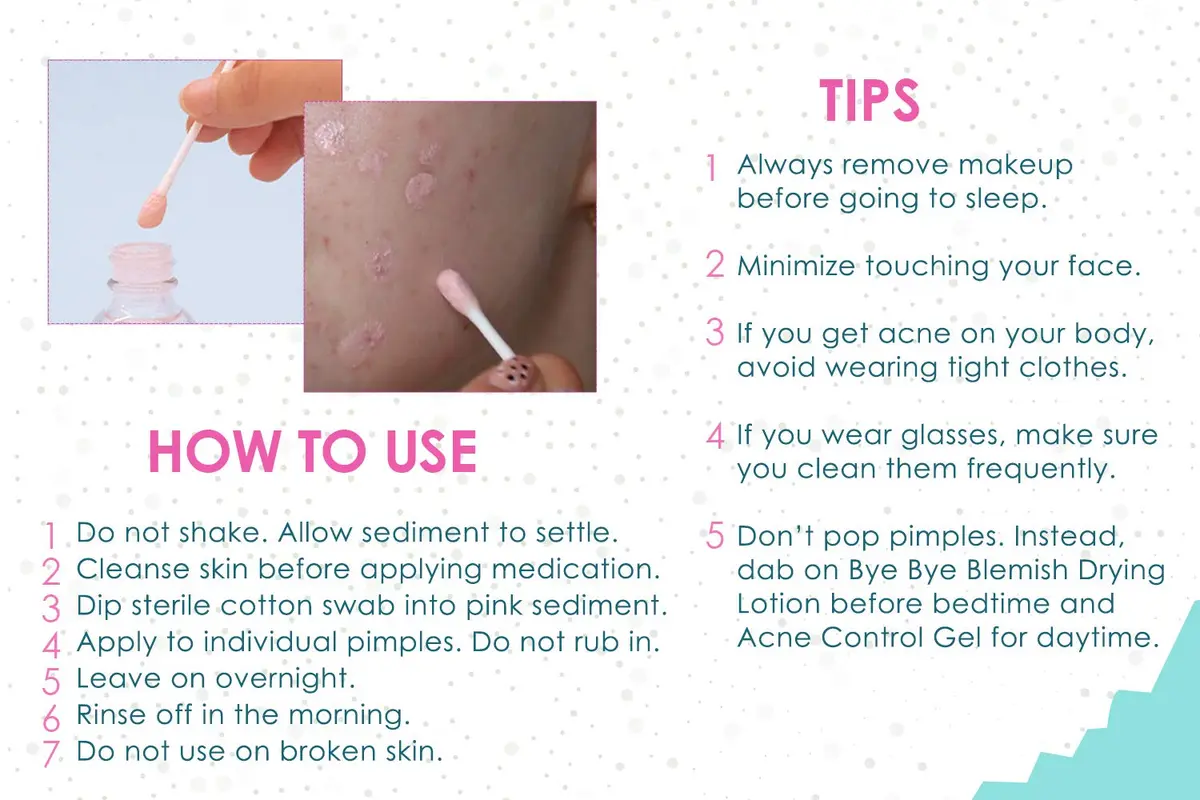 Bye Bye Blemish Acne Drying Lotion 1oz | Reduce Pimples Overnight for Sensitive Skin - view 4