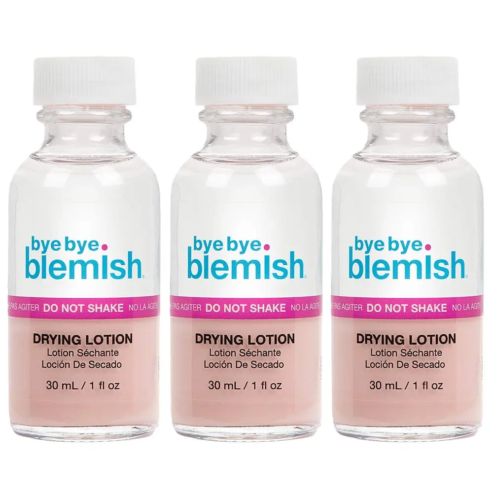 Bye Bye Blemish Acne Drying Lotion 1oz | Reduce Pimples Overnight for Sensitive Skin - main product image
