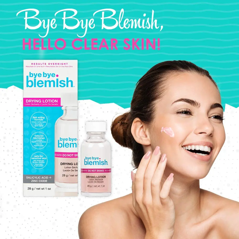 Bye Bye Blemish Acne Drying Lotion 1oz | Reduce Pimples Overnight for Sensitive Skin - view 2