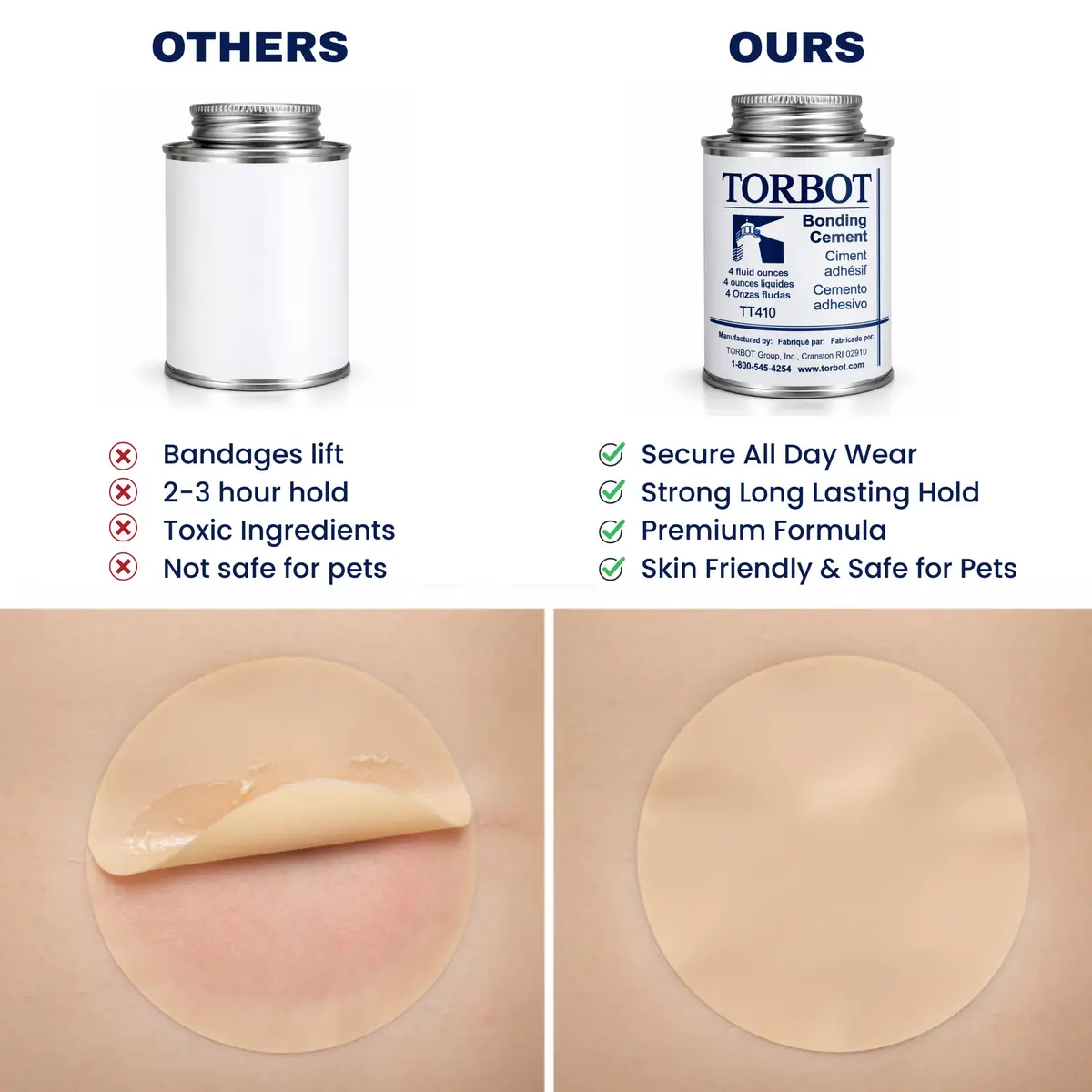 Torbot Liquid Bonding Cement 236ml (8 Fl Oz) | Extra Strong Adhesive for Ostomy Appliances - view 6