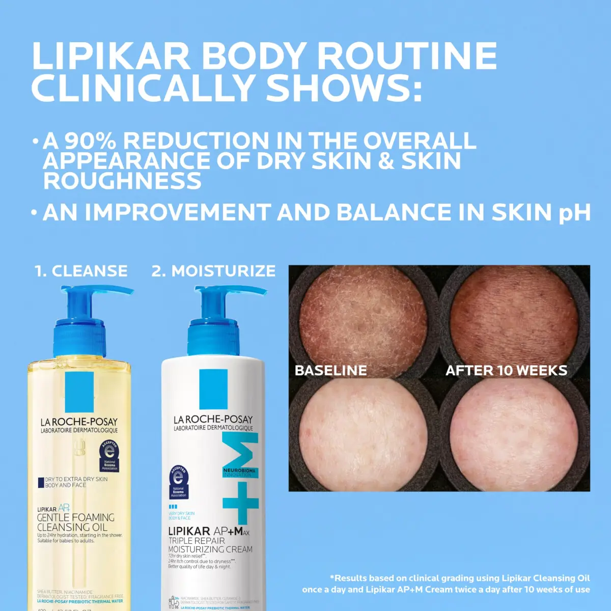 La Roche-Posay Lipikar AP+Max Triple Repair Moisturizing Body Cream 399ml (13.52 Fl Oz) | Advanced Care for Severely Dry Skin - view 4