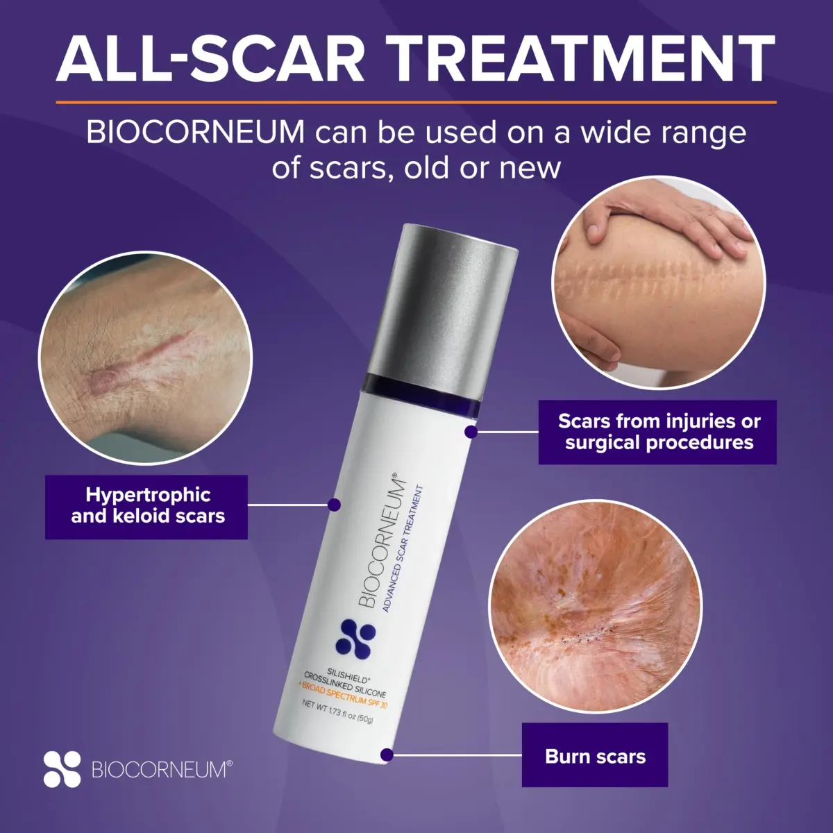 BIOCORNEUM Silicone Scar Gel with SPF 30, 20g (0.69 Fl Oz) | Advanced Scar Treatment with Sun Protection - view 5