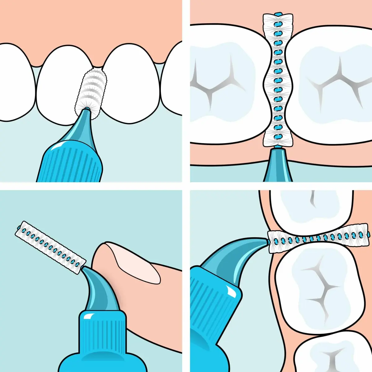 TePe Extra Soft Interdental Brush 0.45 mm (8 Count) | Developed with Dental Experts for Gentle Cleaning - view 4