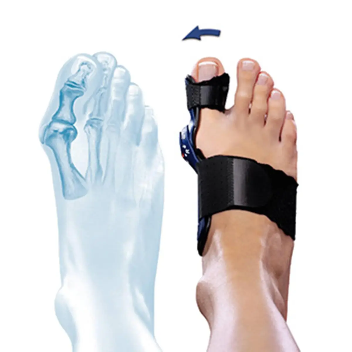 Bauerfeind II Splint for Valgus Bunion Splint Black Universal Size | FDA Approved Medical Grade Support - view 3