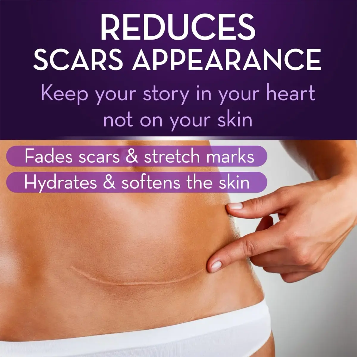 Cicatricure Advanced Scar Gel 28g (1 oz) | Clinically Proven Scar Treatment - view 2