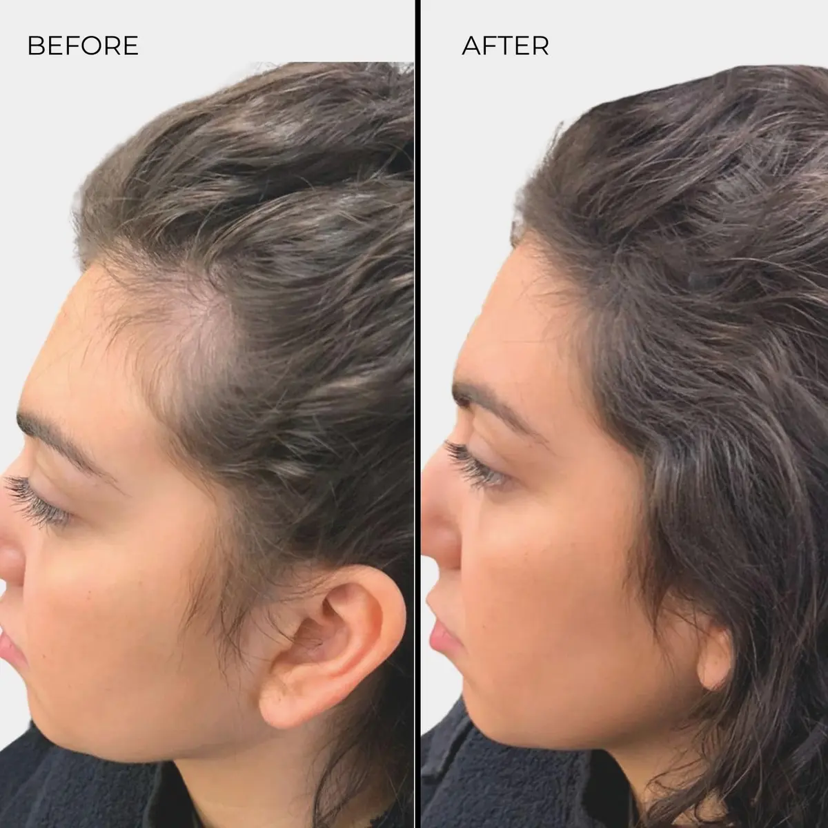 Nanogen Hair Thickening Keratin Fibres Medium Brown | Instant Volume & Density (70-120 chars) - view 4