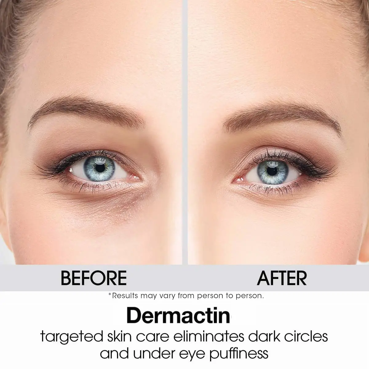 Dermactin Upper Eyelid Cream 29.6ml (1 oz) | Firms & Tones Sagging Skin - view 8