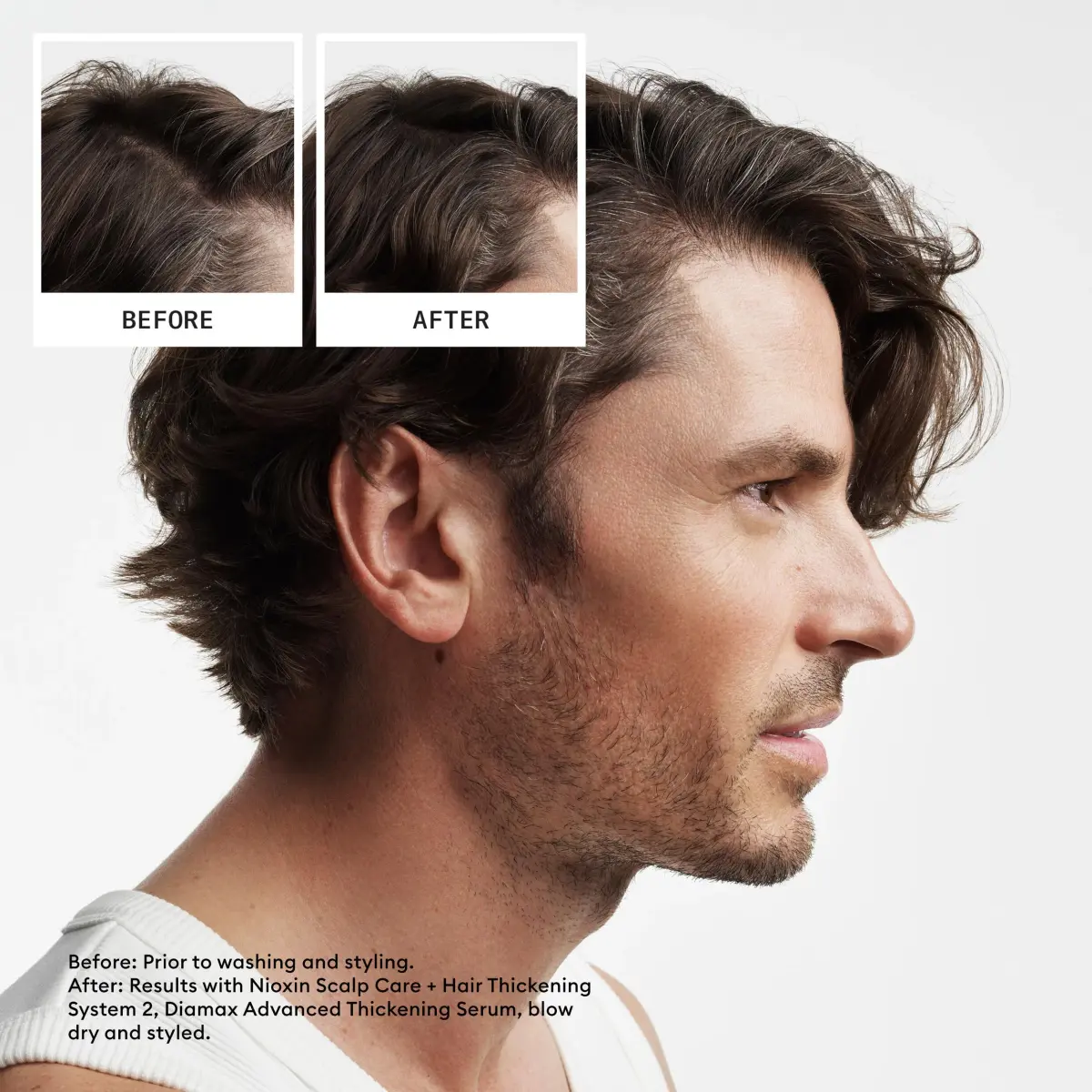 Nioxin System 2 Shampoo for Natural Hair with Progressed Thinning, 298 ml (10.1 Fl Oz) | Thickens Hair & Supports Scalp Health - view 2