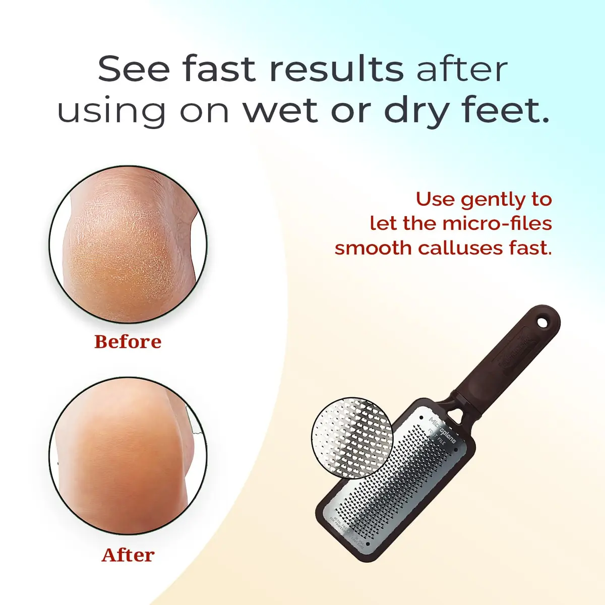 Microplane Colossal Foot File Scraper 5.25in x 2.25in | Stainless Steel Dead Skin Callus Remover for Feet - view 6