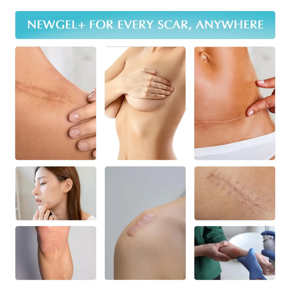 MyNewGel Medical-Grade Silicone Scar Gel with Vitamin E, 0.5 oz | Fast-Drying, Non-Toxic Scar Treatment - view 8