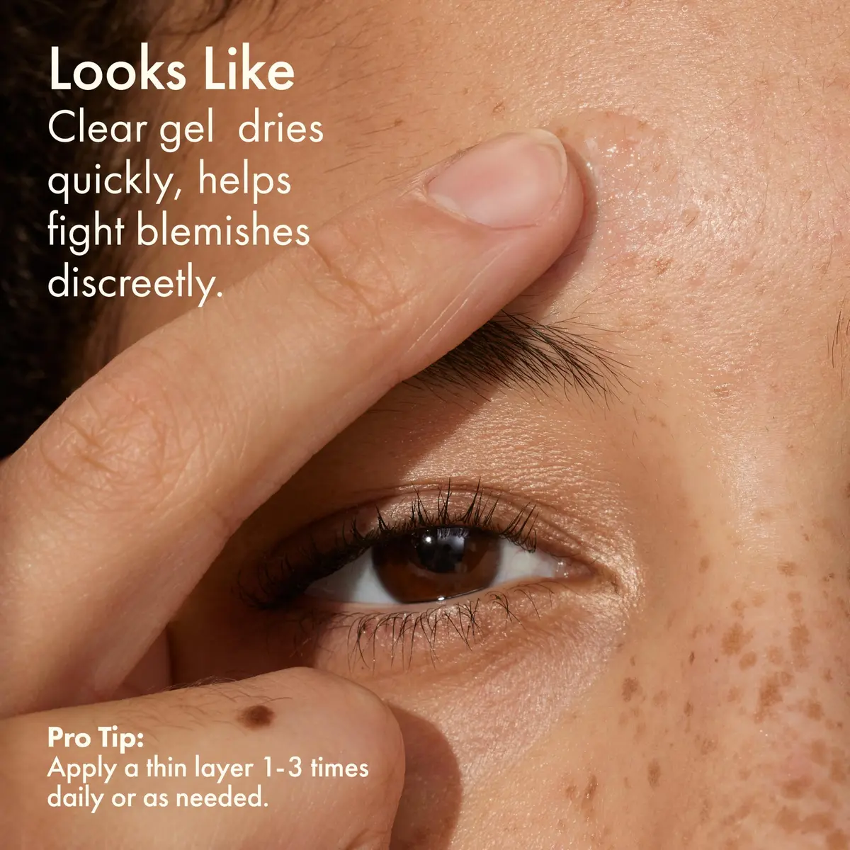 Origins Spot Treatment for Acne | Salicylic Acid 0.34 Fl Oz | Clear Pimples & Blackheads - view 5