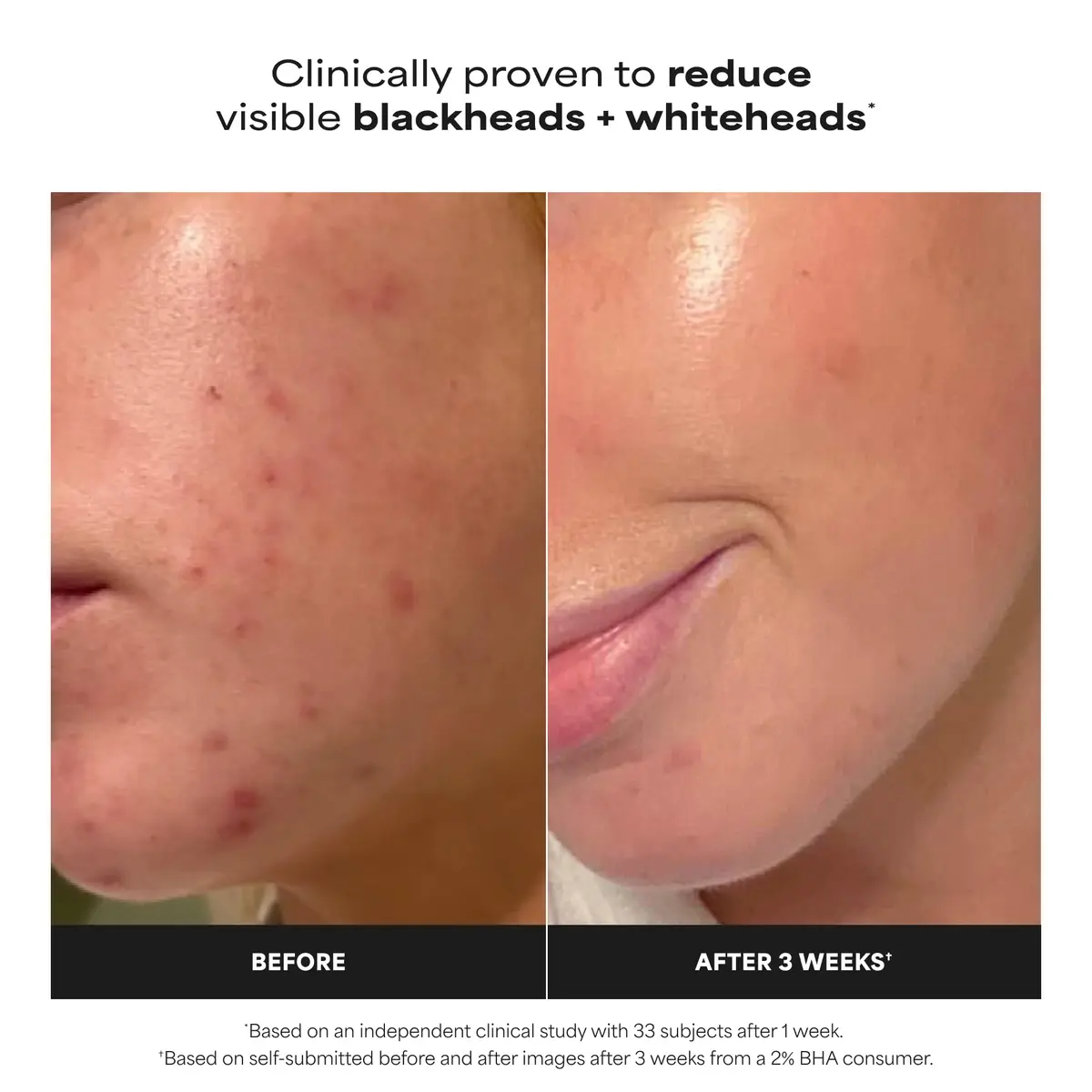 Paula's Choice SKIN PERFECTING 2% BHA Liquid Exfoliant 118ml (4 Fl Oz) | Gentle Chemical Exfoliator for Pores & Blackheads - view 2