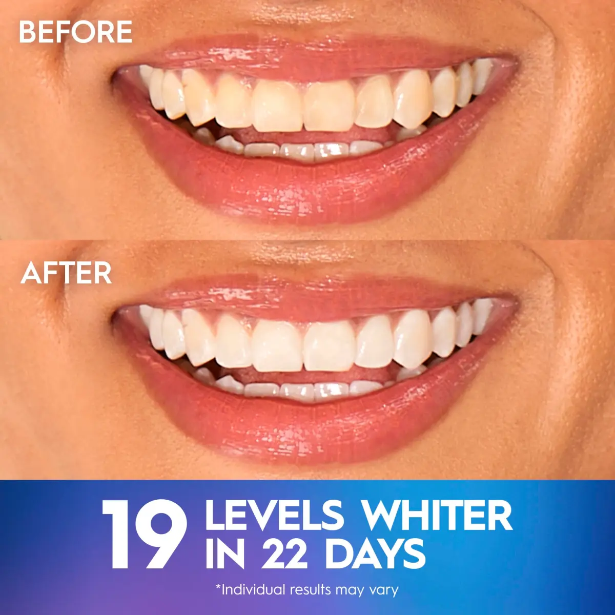 Crest 3D Whitestrips Professional Effects Teeth Whitening Kit 44 Strips (22 Treatments) | Dentist Recommended - view 4