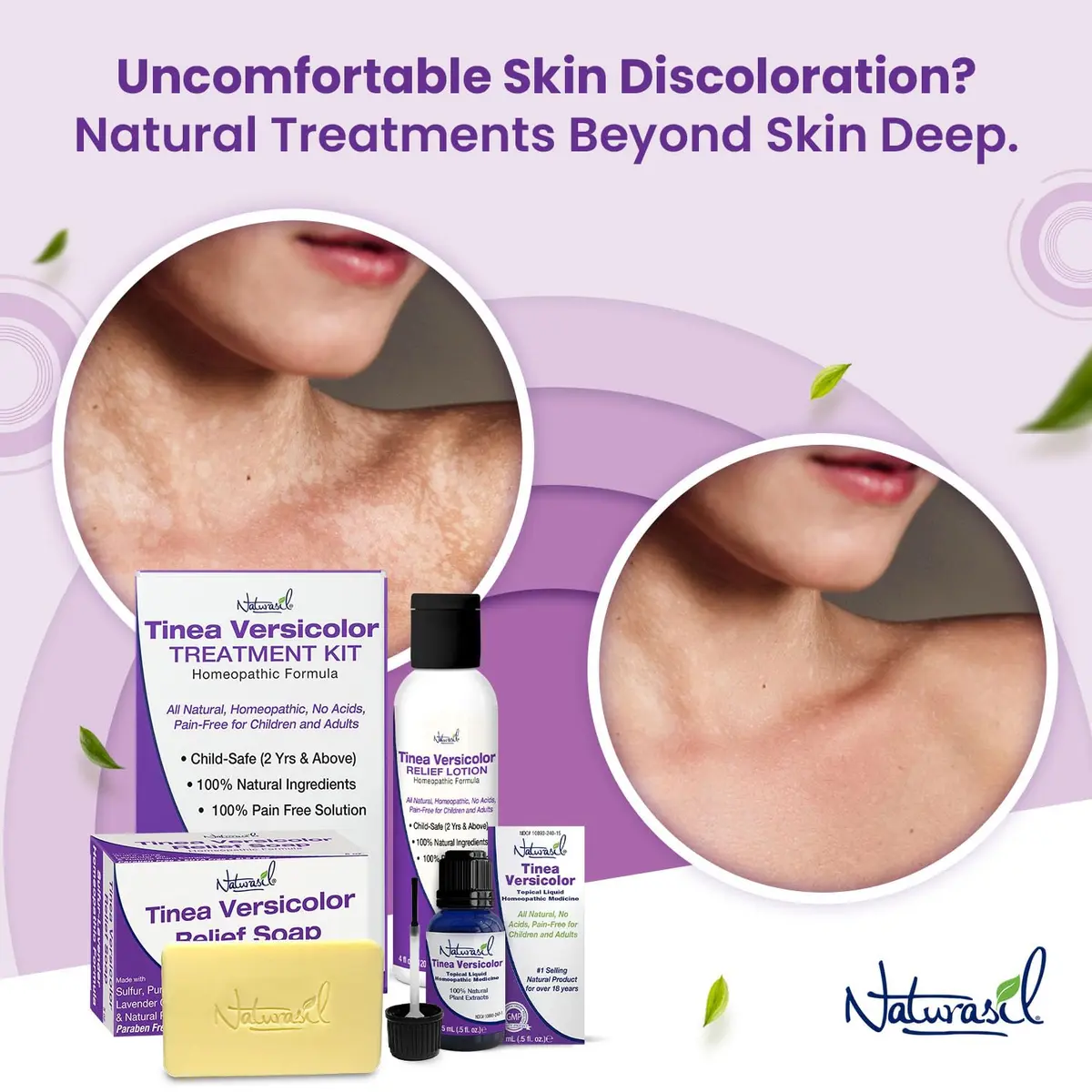 Naturasil Tinea Versicolor Treatment Sulfur Soap 2 Pack | Natural Antifungal Relief for Skin Discoloration - view 2
