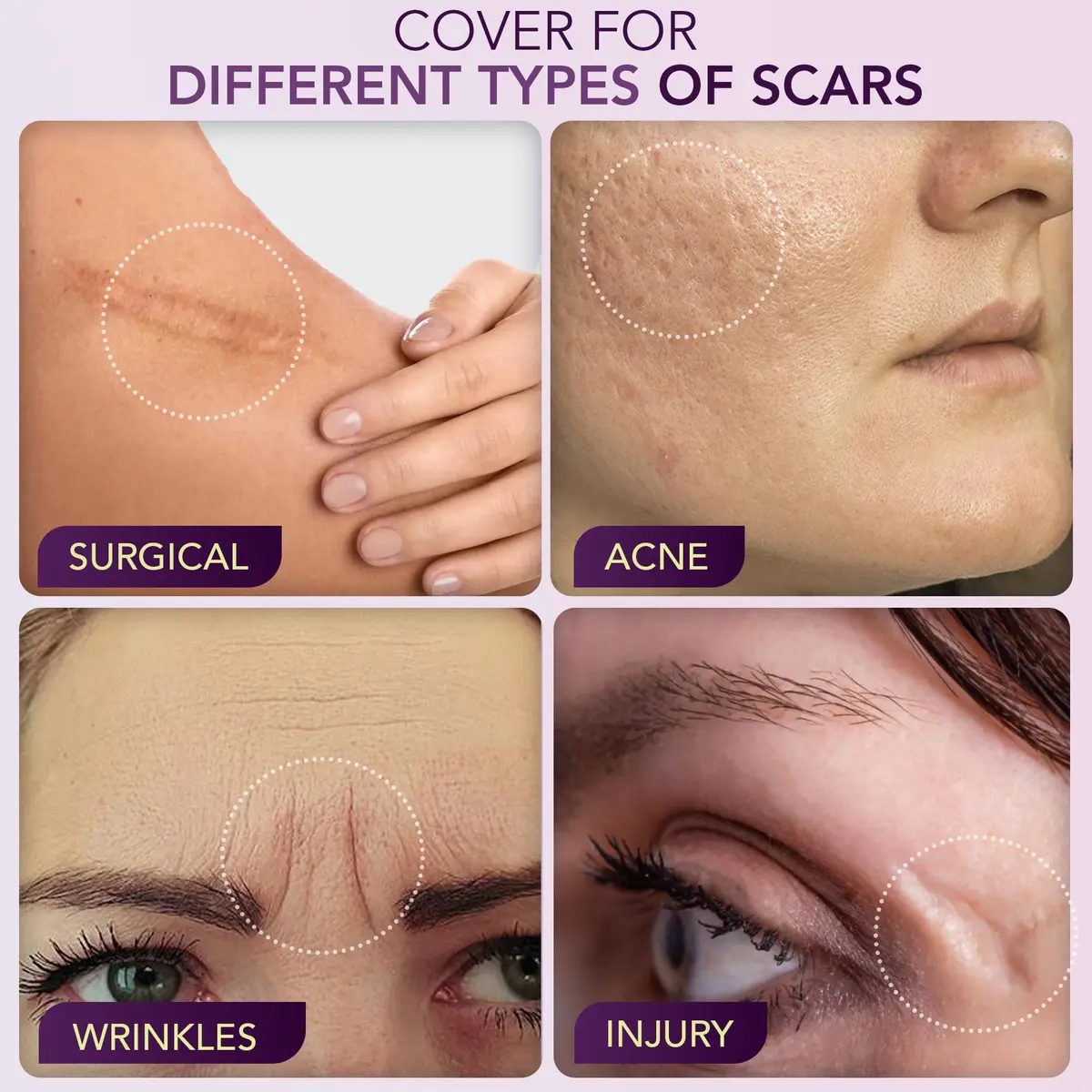 Dermaflage Scar Filler Kit - Deep Skin Tone Waterproof Concealer for Acne & Wrinkles, 1 Count - view 4