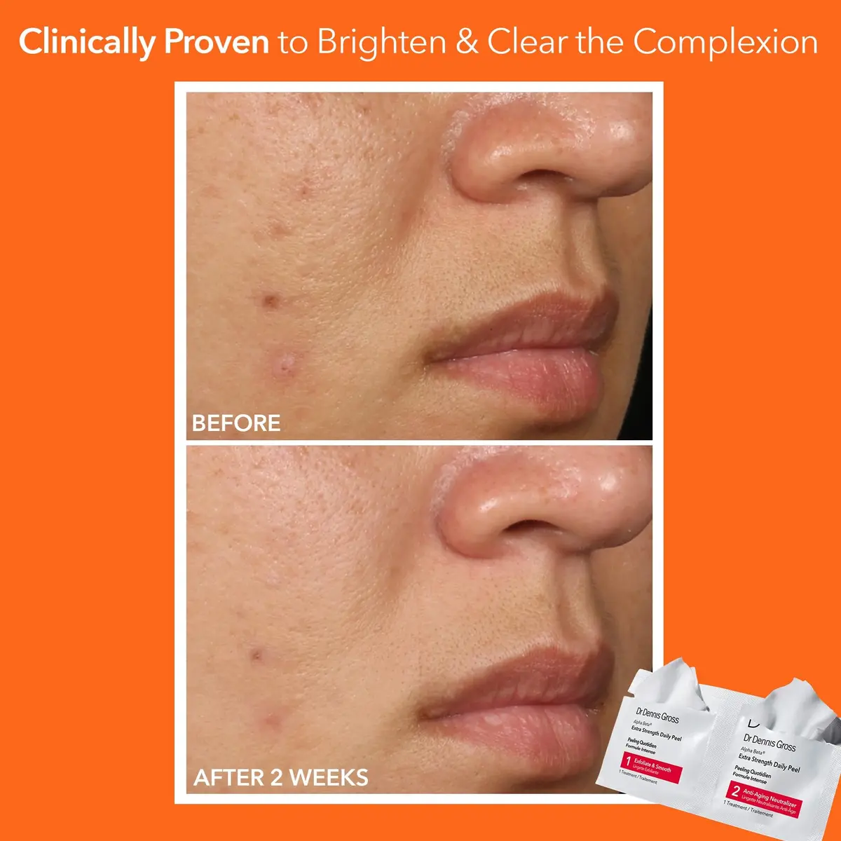 Dr Dennis Gross Alpha Beta Extra Strength Exfoliating Daily Peel - 60 Pack | Professional Results at Home - view 4