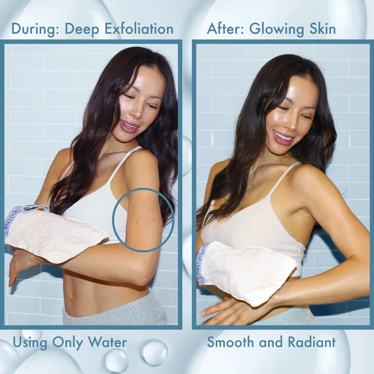 MicrodermaMitt Deep Exfoliating Mitt for Body | Natural Skin Care & Dead Skin Removal - view 5