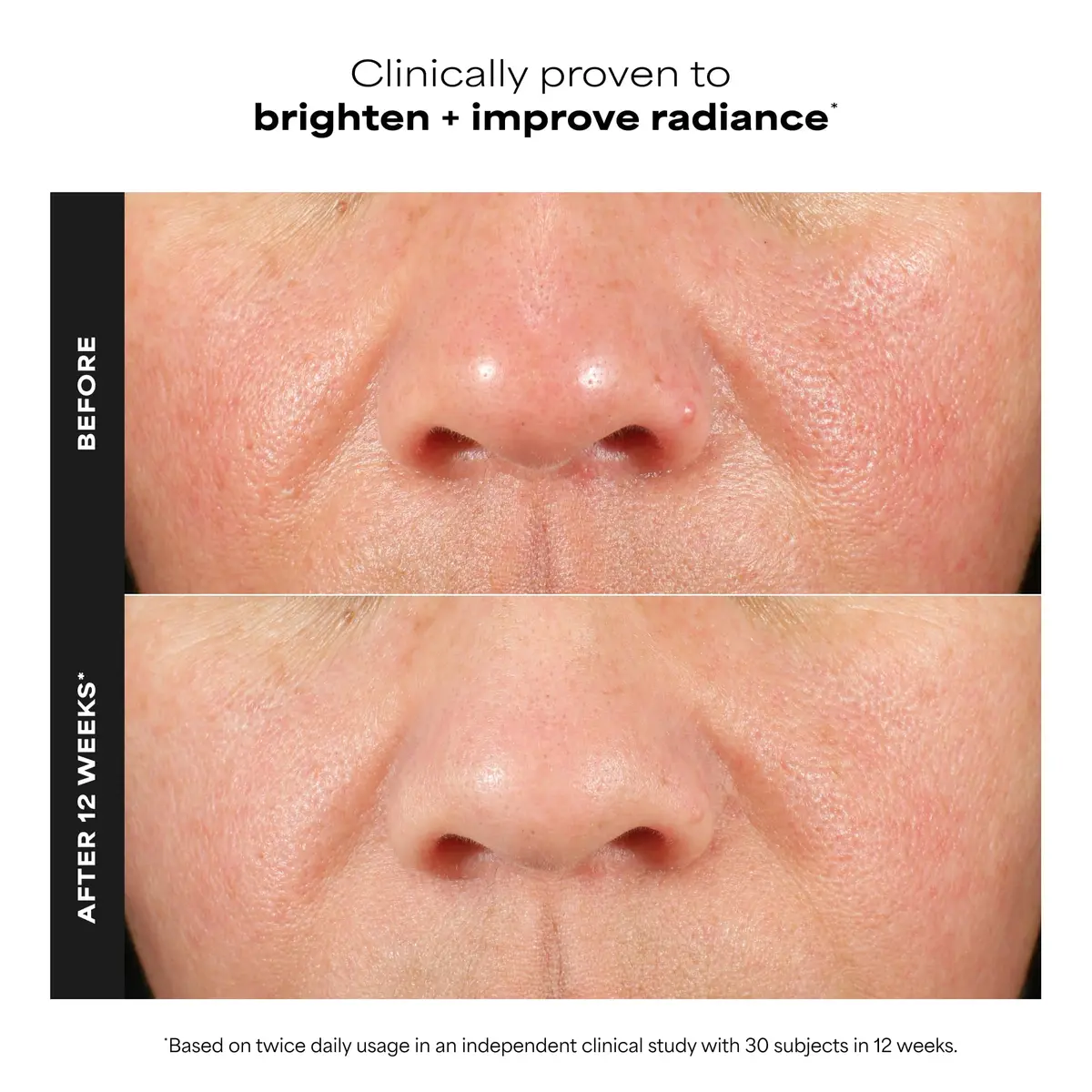 Paula's Choice C15 Super Booster Vitamin C Serum 20ml (0.67 Fl Oz) | Brightens Skin & Boosts Glow - view 2
