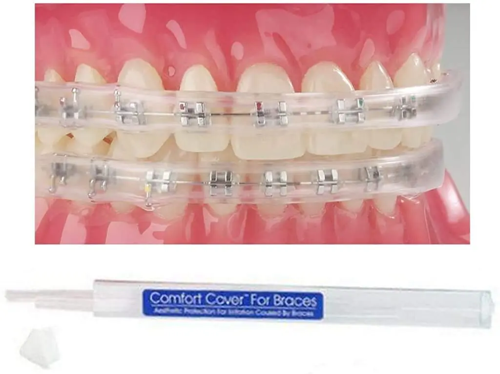 Sonic Dental Comfort Guard Mouth Guard for Braces | Orthodontic Lip Shield Relief - main product image