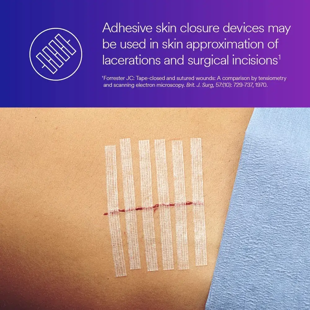 3M Steri-Strip Reinforced Adhesive Skin Closures 6 mm x 100 mm (1/4 in x 4 in) | Hypoallergenic Wound Dressing - view 5