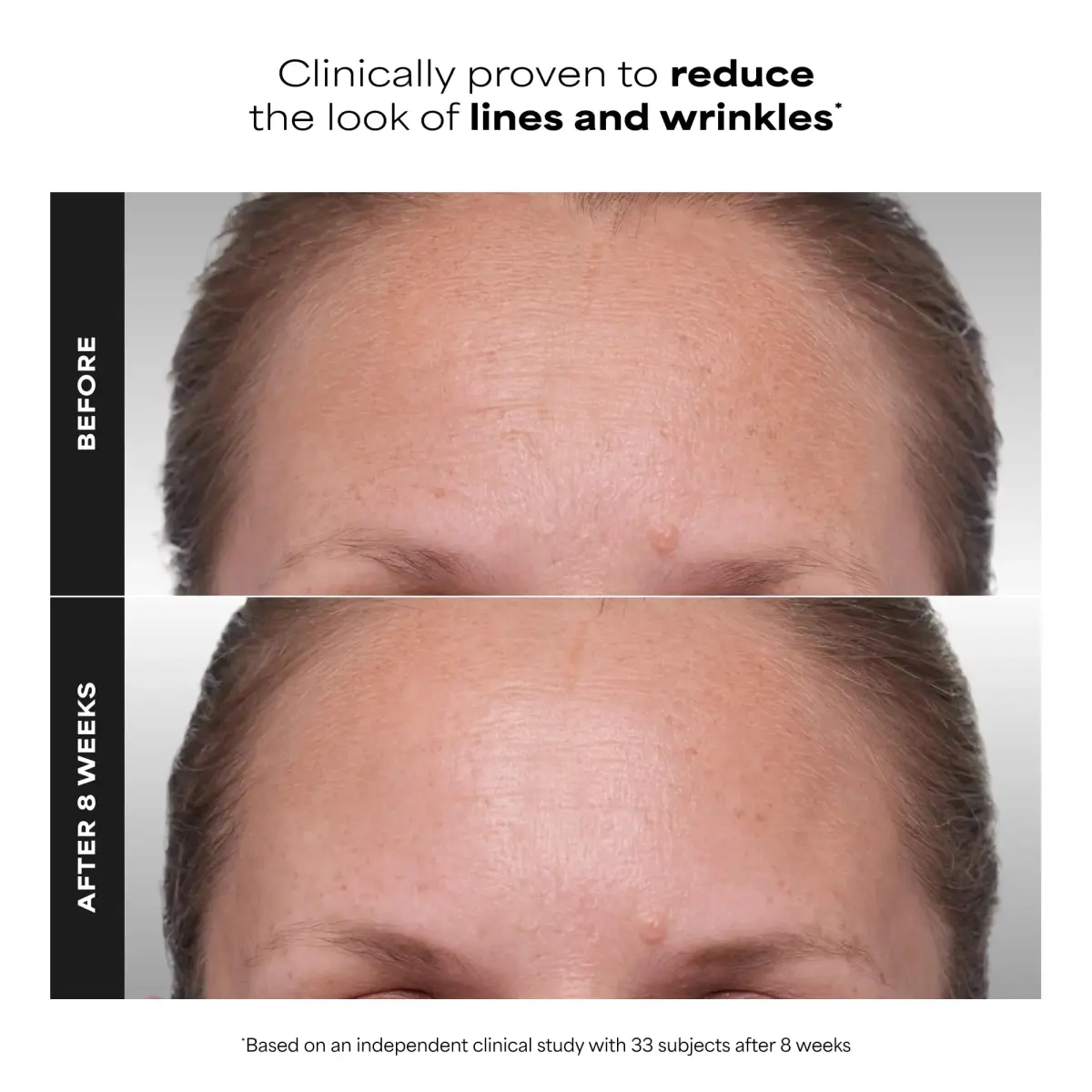 Paula's Choice CLINICAL 1% Retinol Face Treatment with Peptides & Vitamin C, 28ml (1 Fl Oz) | Advanced Anti-Aging Serum for Wrinkles & Fine Lines - view 5