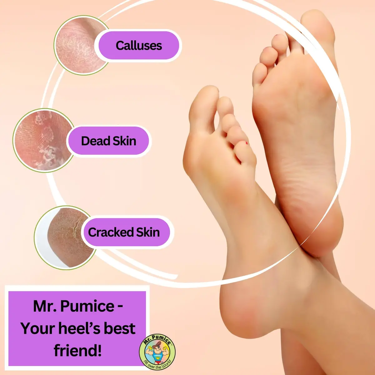 Mr. Pumice PUMI Bar Foot Callus Remover, Extra-Coarse, Purple, 4 Count | Dead Skin & Callus Smoother - view 2