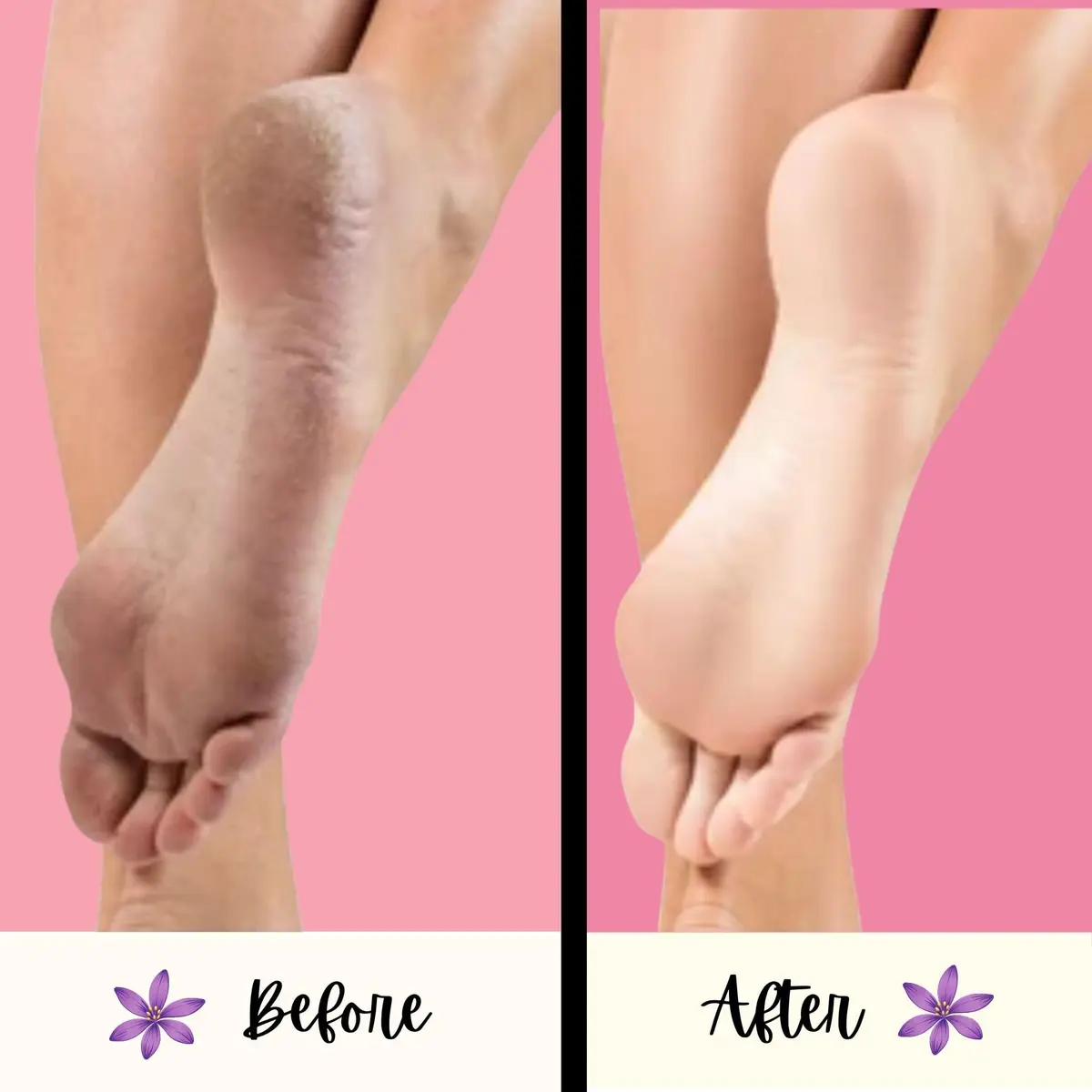 Mr. Pumice PUMI Bar Foot Callus Remover, Extra-Coarse, Purple, 4 Count | Dead Skin & Callus Smoother - view 3