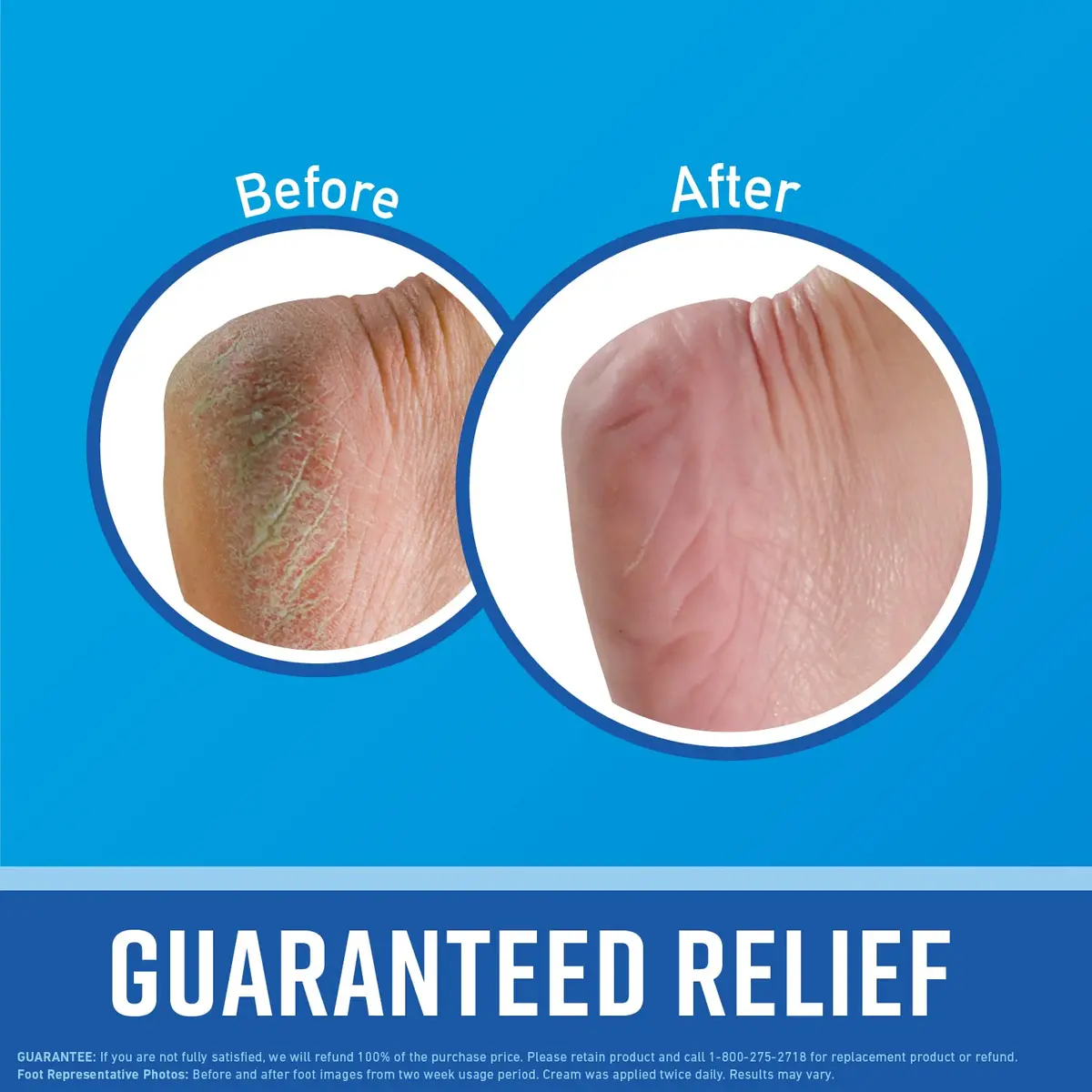 O'Keeffe's Working Hands Hand Cream & Healthy Feet Foot Cream Combo Pack 100.6g (3.4 oz + 3.2 oz) | Intensive Dry Skin Repair - view 6