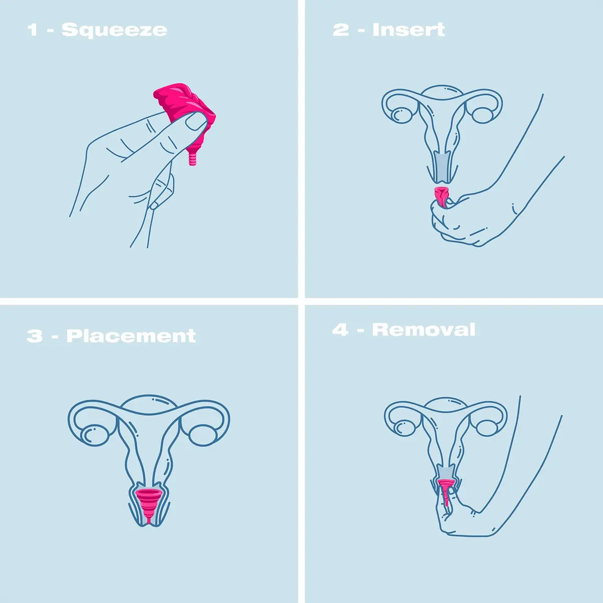 INTIMINA Lily Cup Compact Size A Menstrual Cup | Reusable, Flat-Fold, Pink - view 5