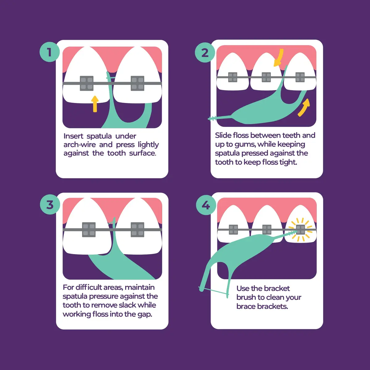 Platypus Orthodontic Flossers for Braces, 180 Count (Pack of 6) | Orthodontist Recommended for Braces - view 3
