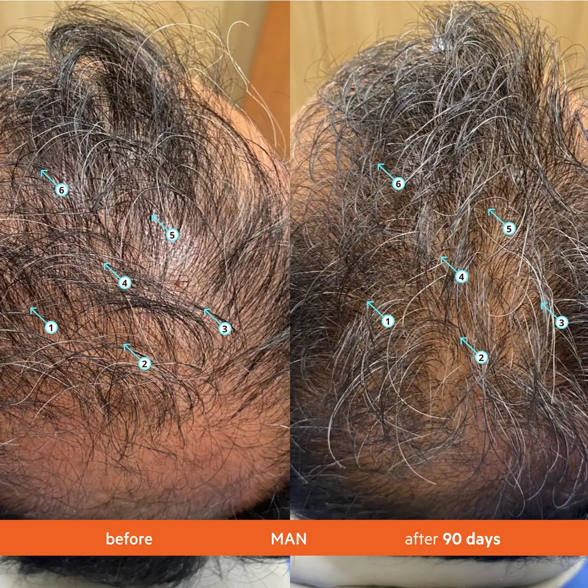 ds labs Revita Hair Density Shampoo & Conditioner for Thinning Hair | Fuller, Hydrated Hair, 205 mL - view 4