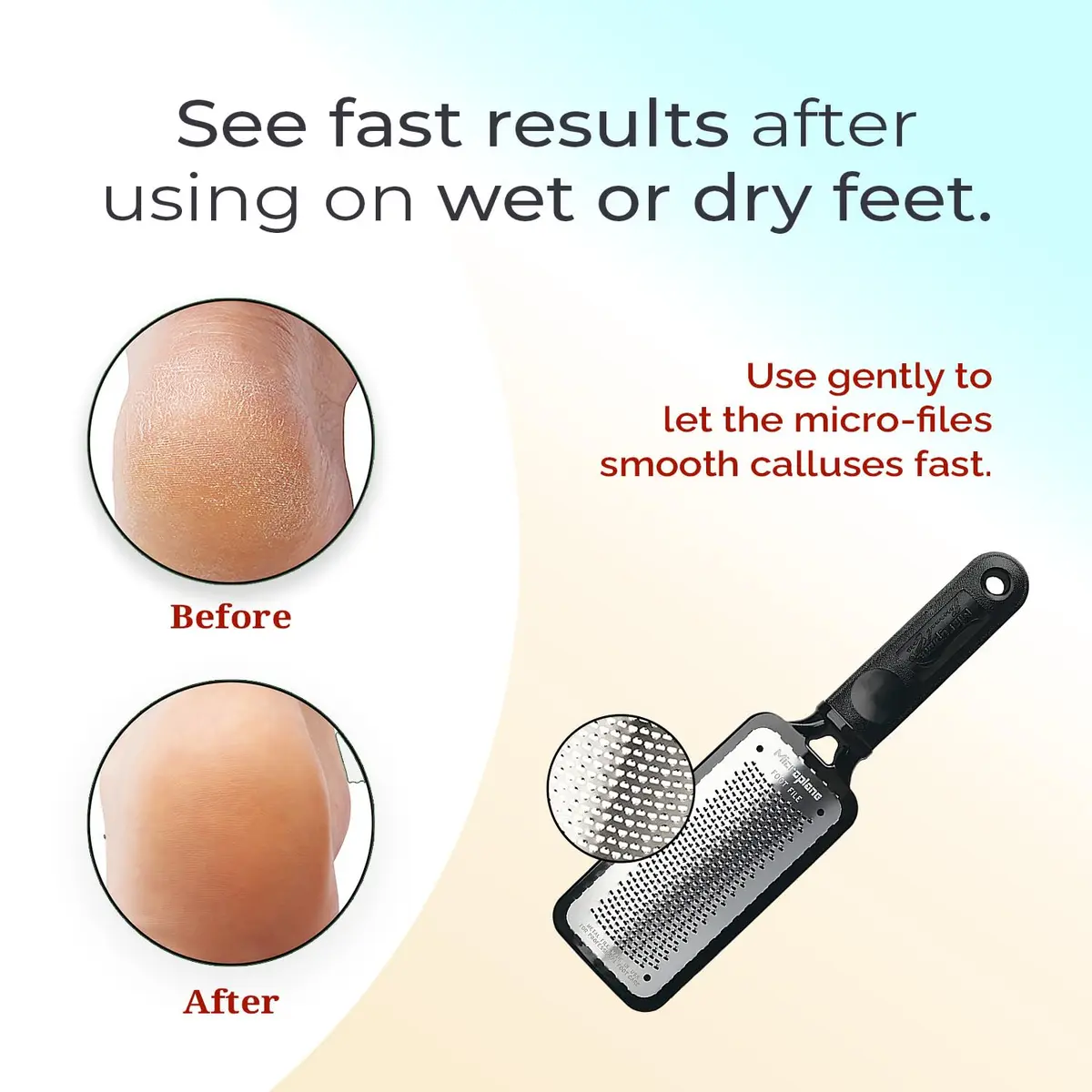 Microplane Foot Scraper White | Stainless Steel Dead Skin Remover for Feet - view 5