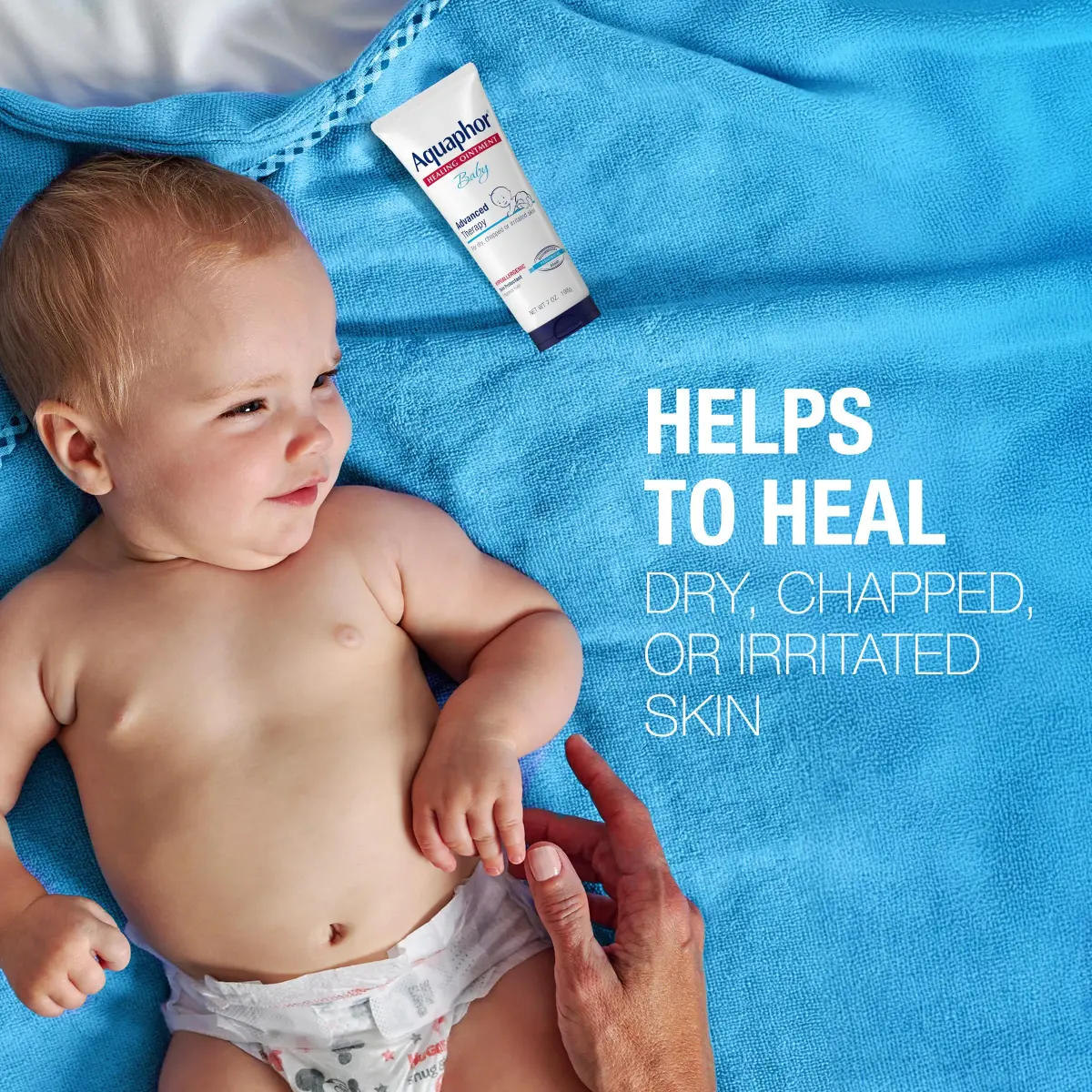 Aquaphor Baby Healing Ointment 198g (7 Oz) | Clinically Proven for Diaper Rash & Dry Skin - view 3