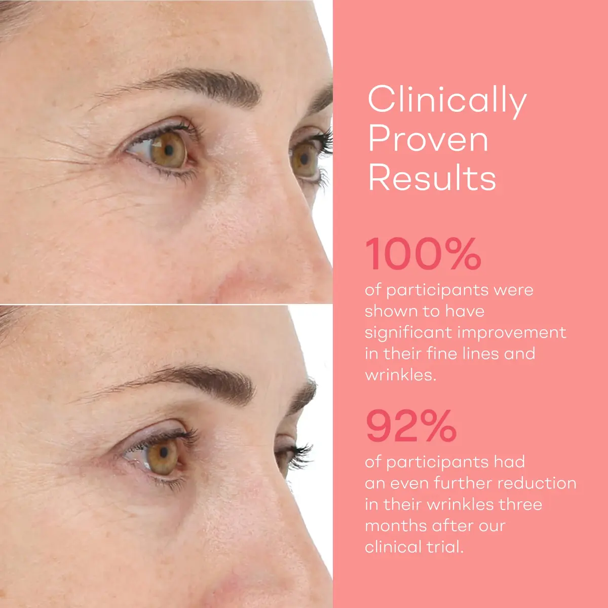 LightStim for Wrinkles LED Red Light Therapy with 72 LEDs | FDA Cleared Anti-Aging Device - view 4