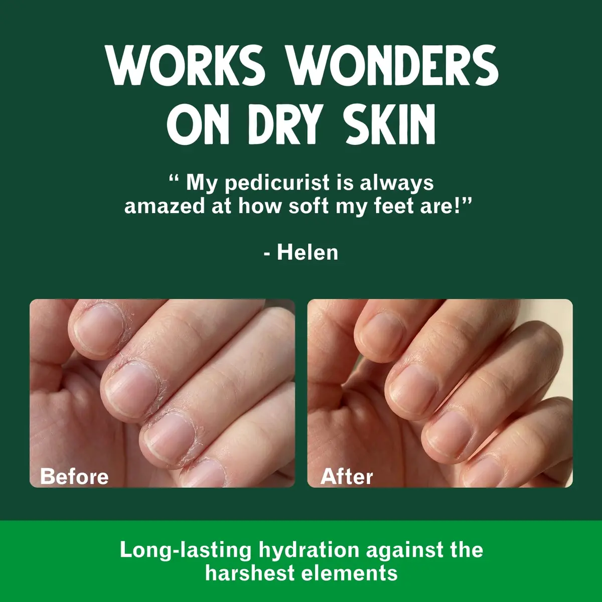 Bag Balm Vermont's Original Skin Moisturizer 4oz | Full-Body Hydrating Skin Care for Dry Hands & Lips - view 4