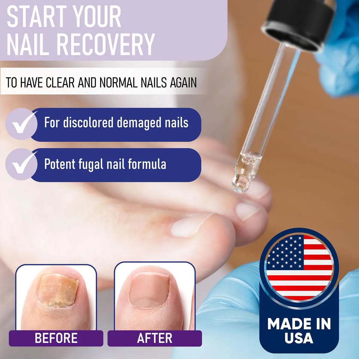 Zanaquick Extra Strength Toenail & Fingernail Repair Drops 0.5 Fl Oz (2 Pack) | Supports Healthy Nails - view 3