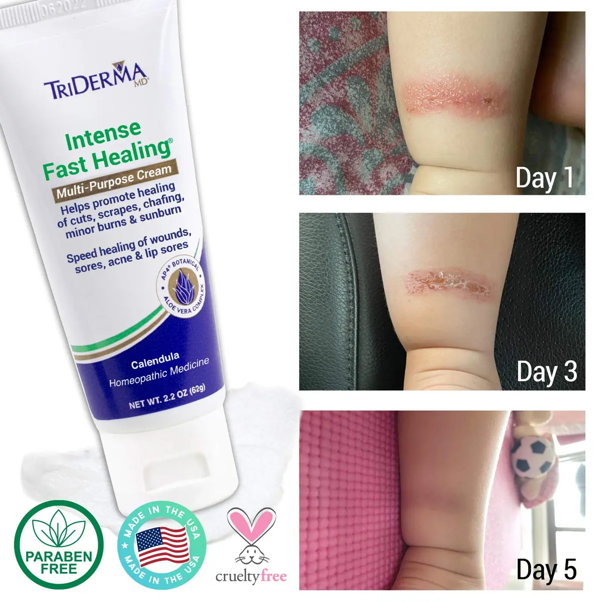TriDerma Intense Fast Skin Healing Cream 2.2 oz | All-Purpose Skin Repair for Sensitive Skin - view 6