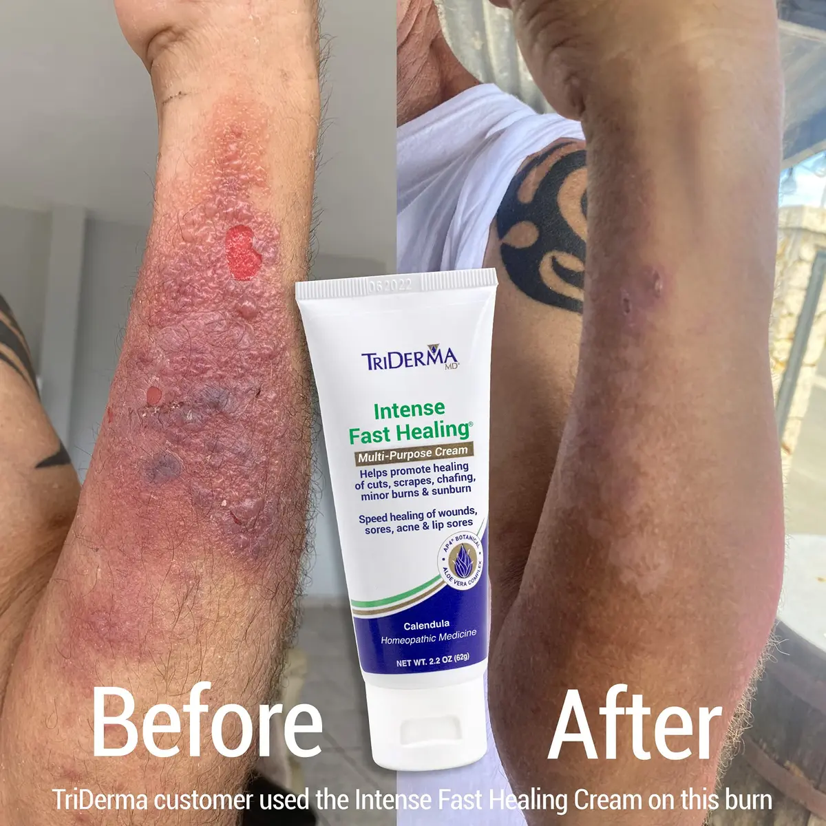 TriDerma Intense Fast Skin Healing Cream 2.2 oz | All-Purpose Skin Repair for Sensitive Skin - view 2